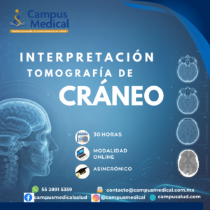 Curso Online de Interpretación de Tomografía de Cráneo