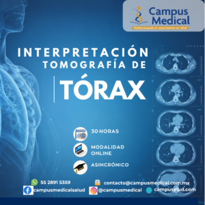 Curso Interpretación de Tomograífa de Tórax